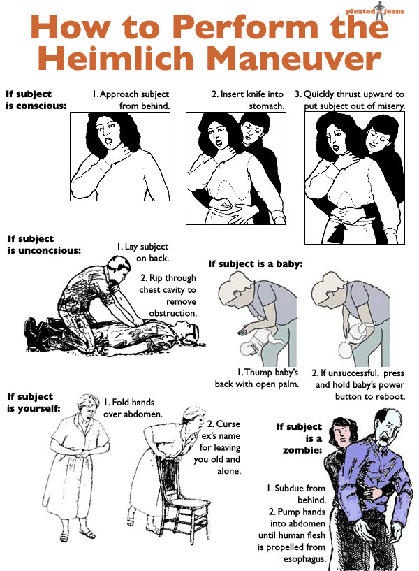 Heimlich Maneuver Cpr Dos And Donts 7396