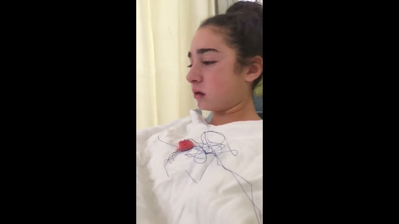 Maria's Wisdom Tooth Removal
