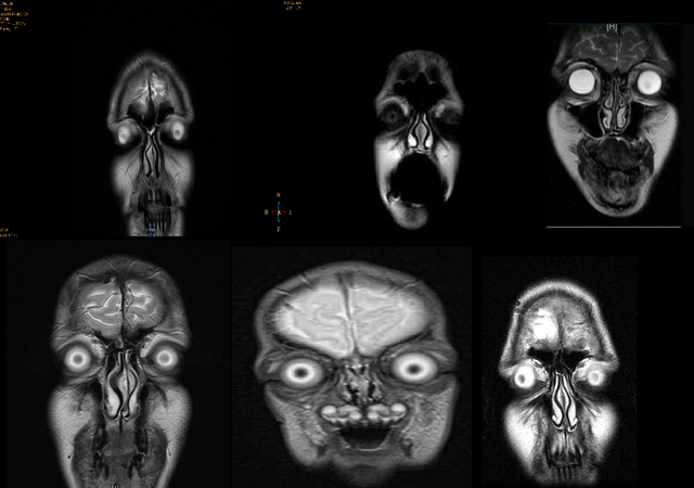 cursed ct scan, cursed x ray, cursed mri, cursed ct scan image, funny ct scan image, funny x ray image
