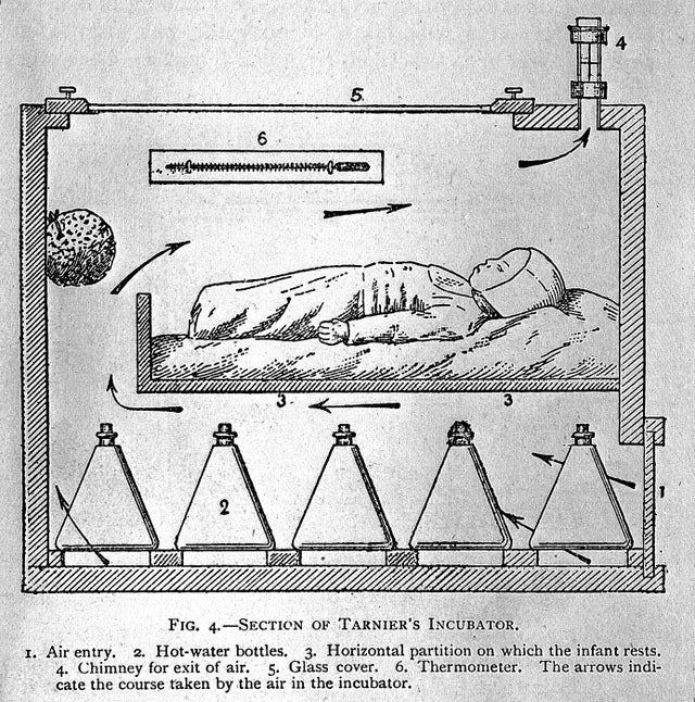 cross section of baby incubator, baby incubator cut in half, thing cut in half, things cut in half, cool thing cut in half, cool things cut in half, thing cut in half picture, interesting thing cut in half, interesting things cut in half, picture of thing cut in half, ordinary things cut in half, pictures of things cut in half, photos of things cut in half, amazing pictures of things cut in half, awesome photos of things cut in half, awesome pics of things cut in half, awesome pictures of things cut in half, cool things cut in half, everyday things cut in half, images of things cut in half, random things cut in half, things cut in half cool, things cut in half meme, things cut in half photos, things cut in half pics, things cut in half picture, unusual photos of things cut in half, interesting cross section, interesting cross sections, cross section, cross section picture cool cross section, cross sections, cool cross sections, cross section image