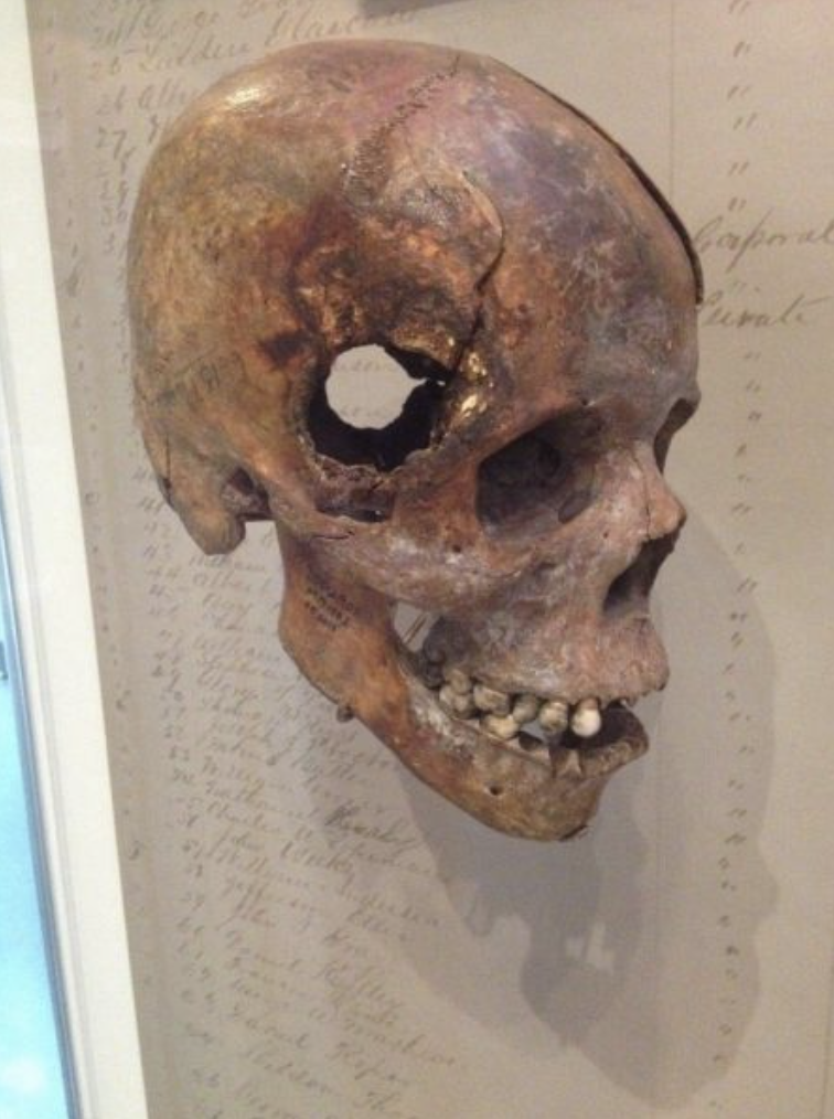 interesting posts - civil war skull