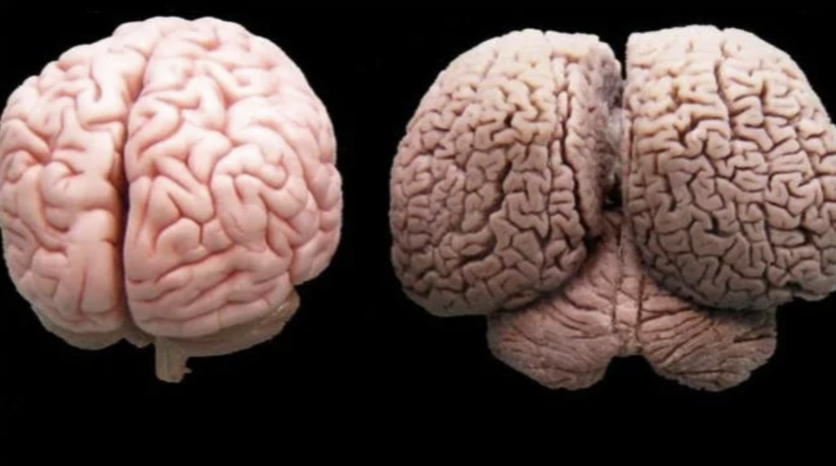 interesting posts - human brain vs dolphin brain 