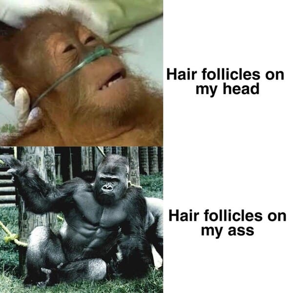 funny bald meme - hair follicles on my head vs butt