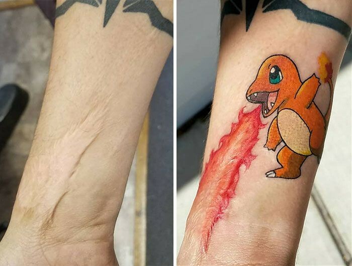 cool first tattoo ideas - scar cover up charmander