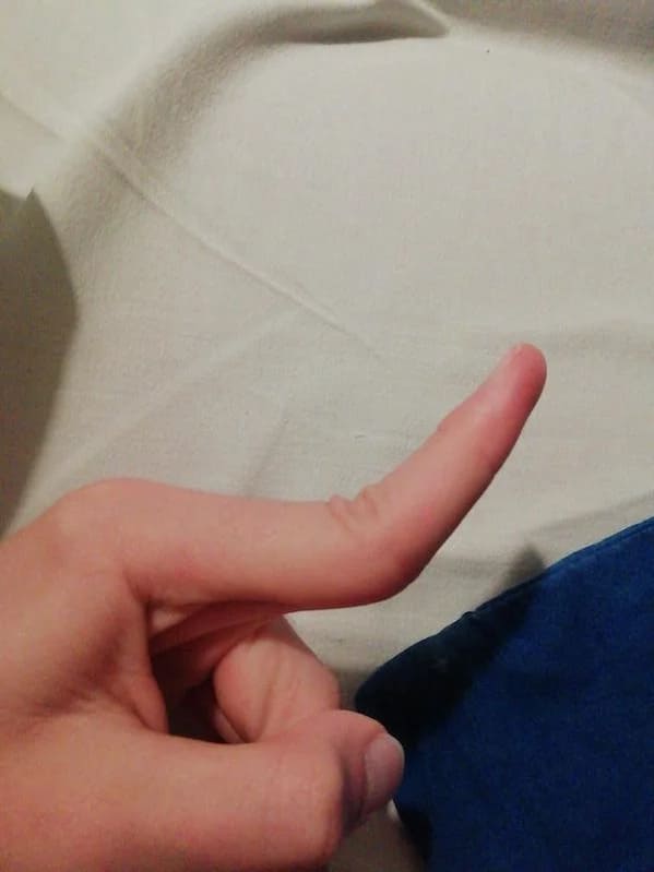 bizarre photos - bent finger