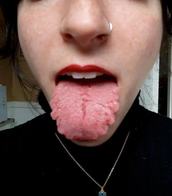 bizarre photos - geographic tongue