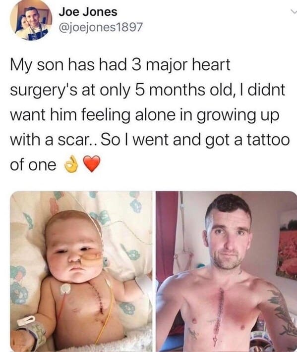 bros helping bros - dad gets scar tattoo of scar frrom sons heart surgery