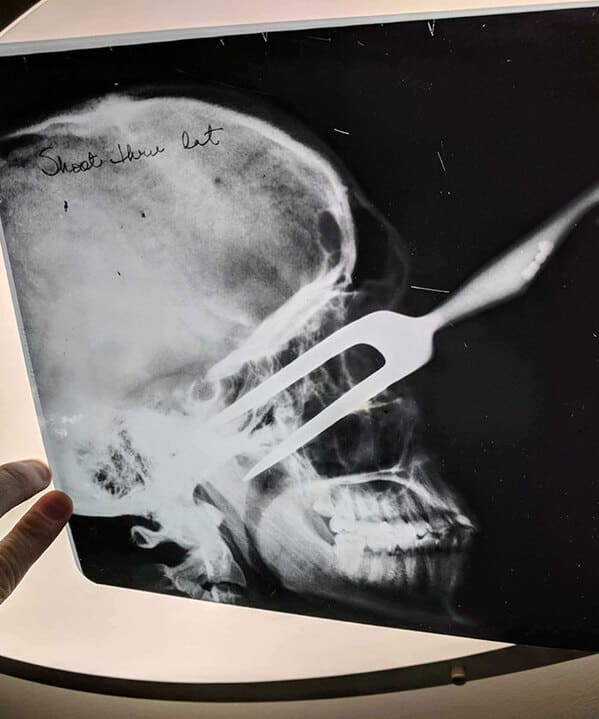creepy discoveries new home - x ray skull