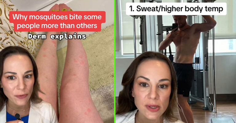 Scientist Dispels Popular Myth About Mosquitoes, Explains Why They Bite Some People More