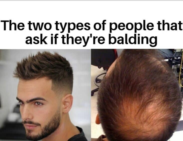 32 Shiny Bald Memes For The Follicly Challenged With An Abundance Of Humor