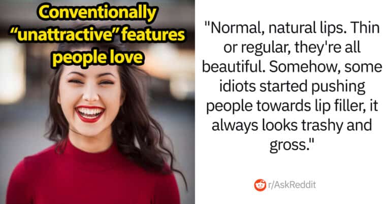 30 Conventionally “Unattractive” Physical Features People Love