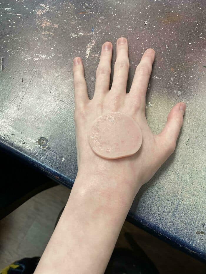 Hand with a round, pink object on the back, resting on a speckled work surface.