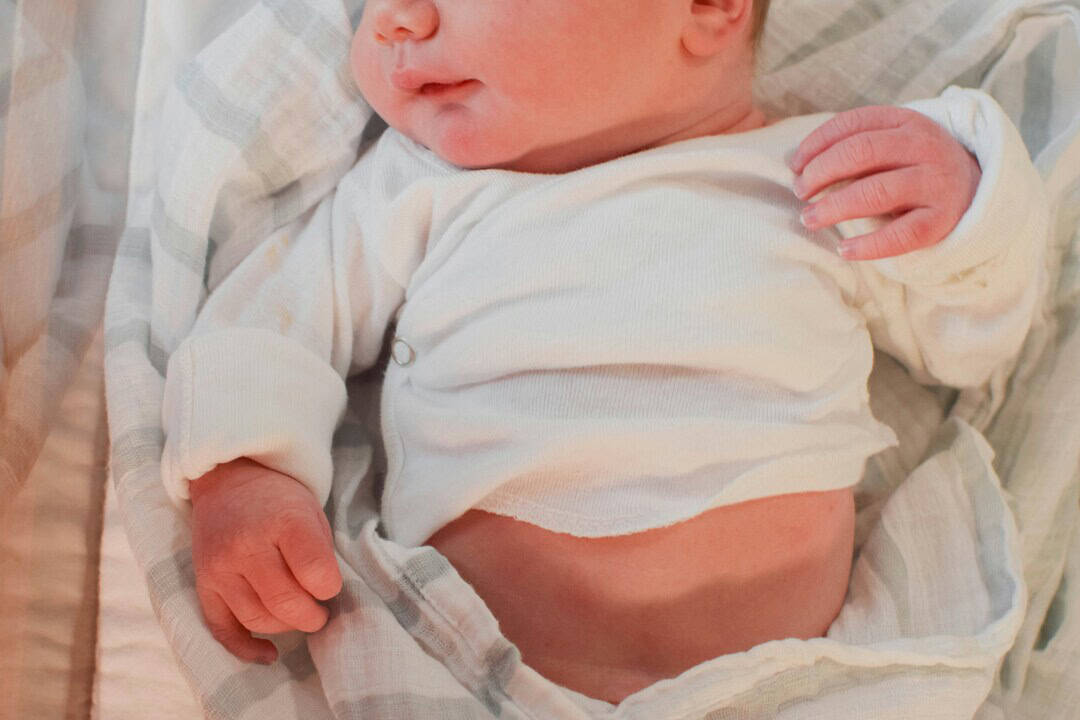 Baby lying on a bed with a visible belly button and relaxed posture.