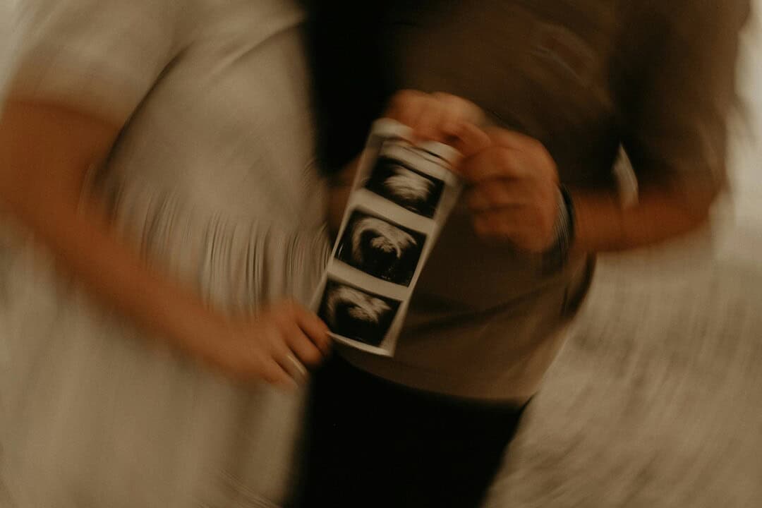 Two people holding ultrasound images, discussing pregnancy scan results.