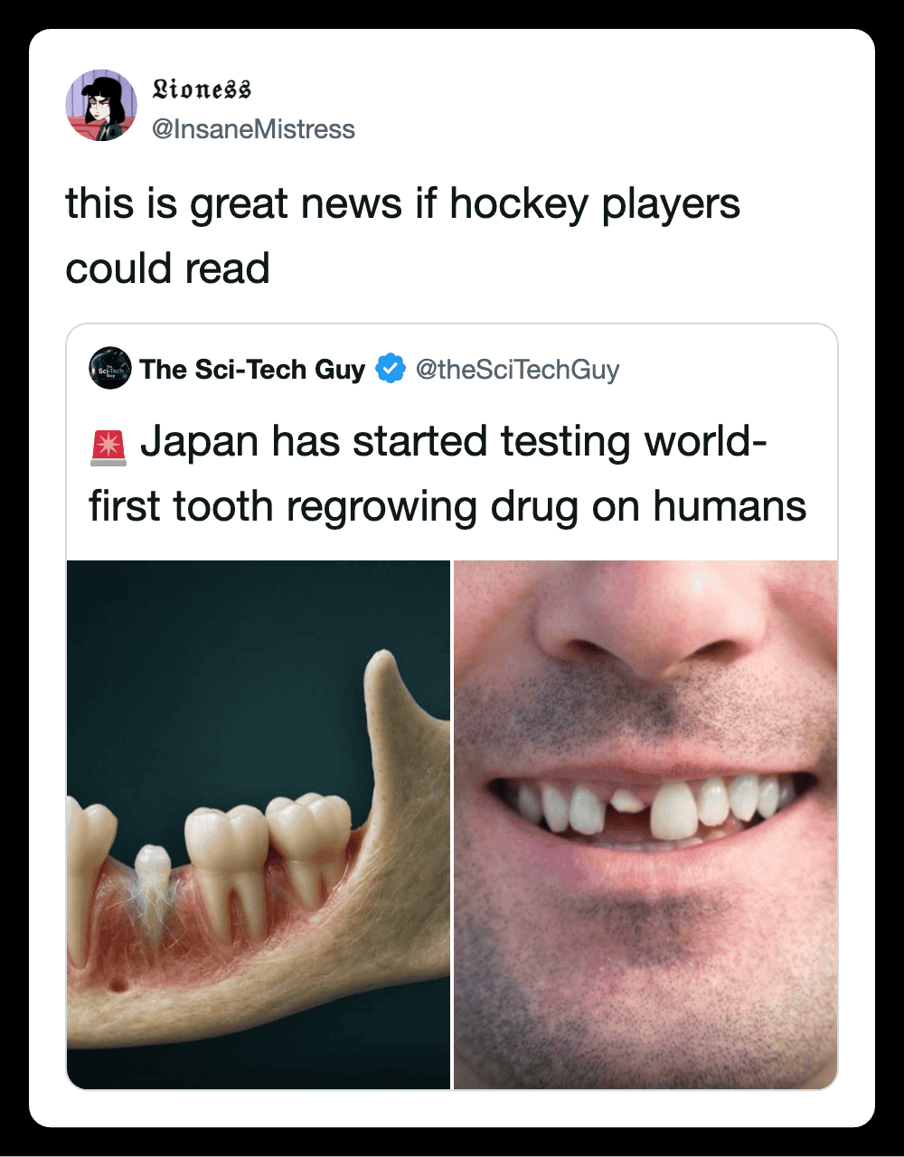 Funny hockey players reading tweets about world’s first tooth regrowing drug.