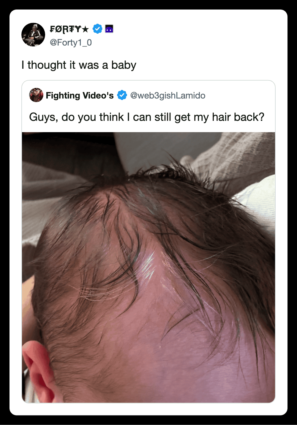 Humorous tweet about hair regrowth with a close-up of a person's thinning hair.