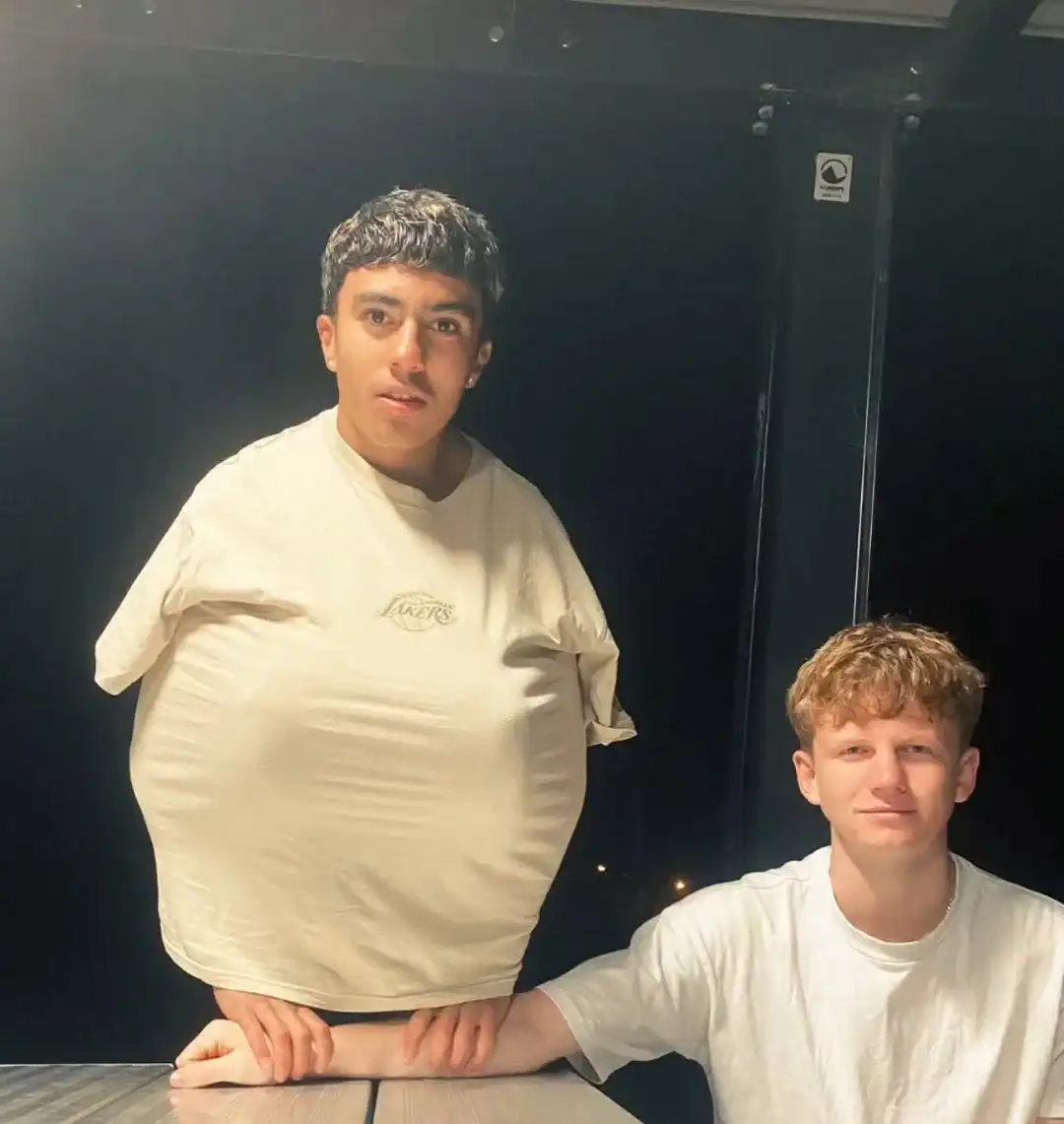 A young man with a large belly standing next to a seated young man with a normal build, both wearing.