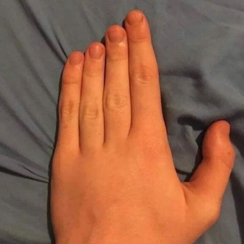 Hand with four fingers extended and thumb tucked, on a gray fabric background.