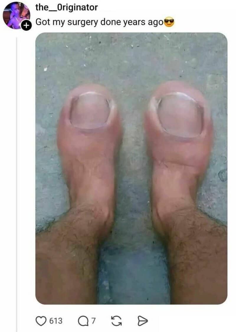 Close-up of two large toes with toenails on a concrete surface.