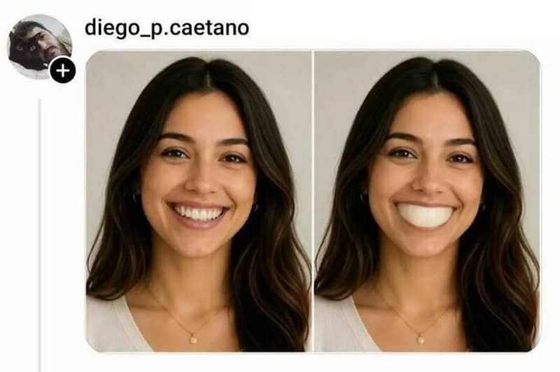 Side-by-side photos of a woman smiling, one with teeth and one with a wide smile.