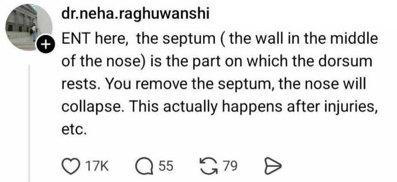 Diagram explaining the septum in the nose and its importance.