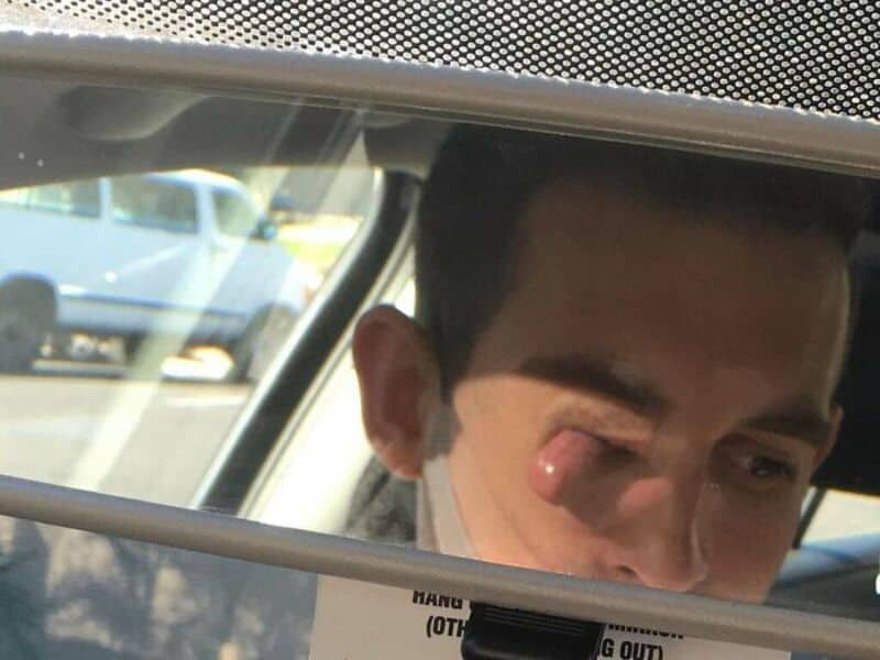 Close-up of a young man's face with a large pimple on his nose, reflected in a car's rearview mirror.