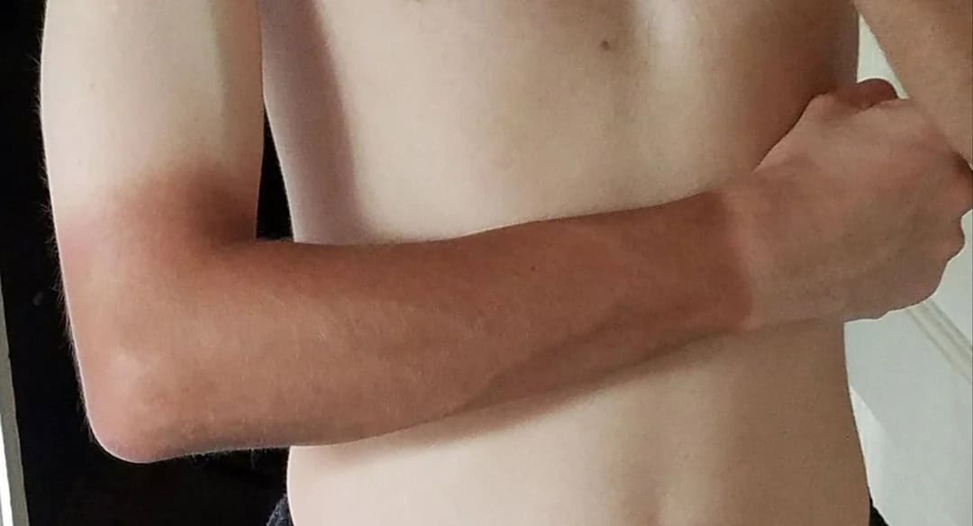 Close-up of a person's arm with a shadow cast on the skin.