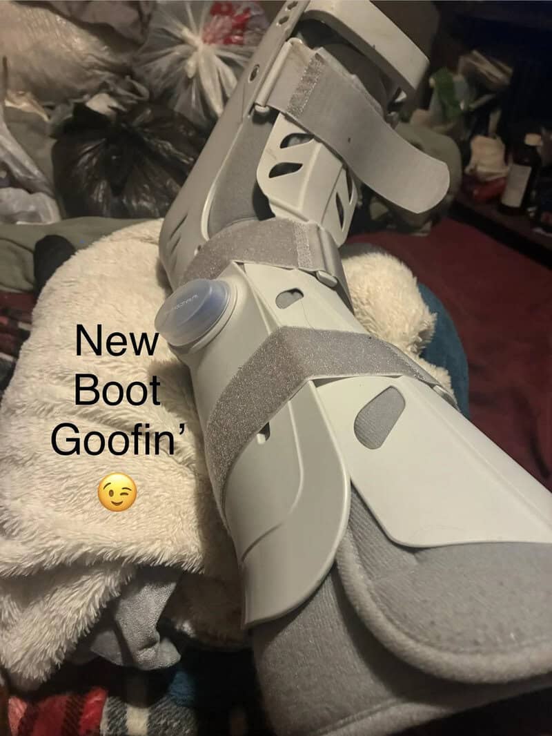 New boot goofin' with a smiley face, showing a medical boot on a person's leg.
