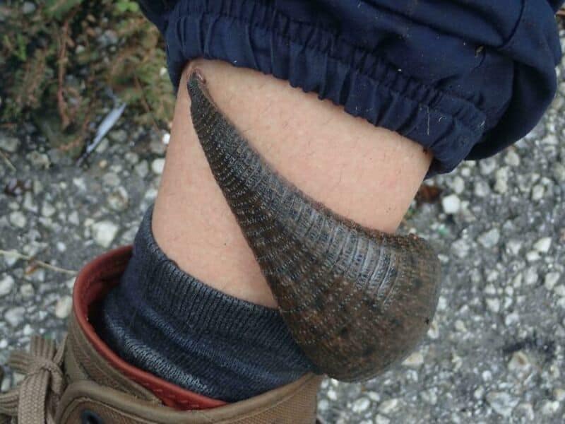 A large snail on a person's ankle, showing its size comparison.