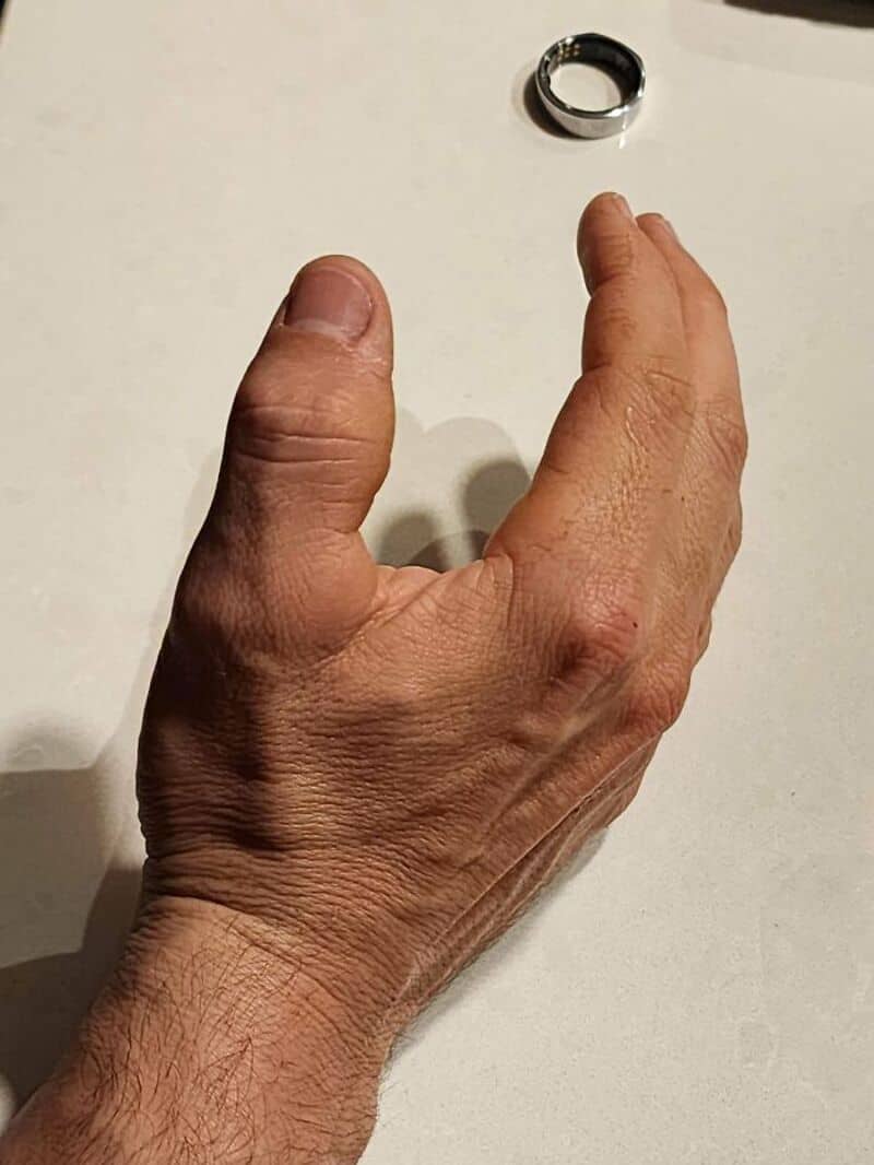 Hand with a ring on the index finger and a ring in the background.