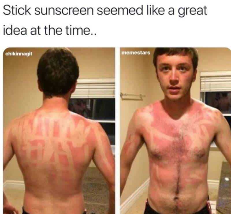 Young man with a sunburn that looks like a message on his back and chest.