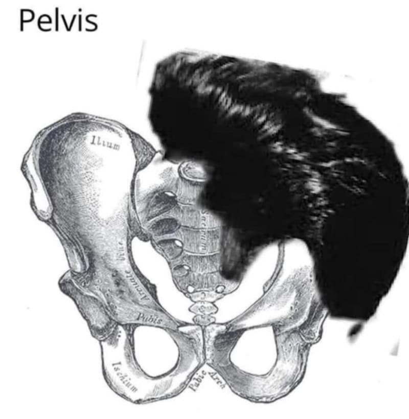 Pelvis with a hairpiece covering part of the image, labeled 'Pelvis' at the top.