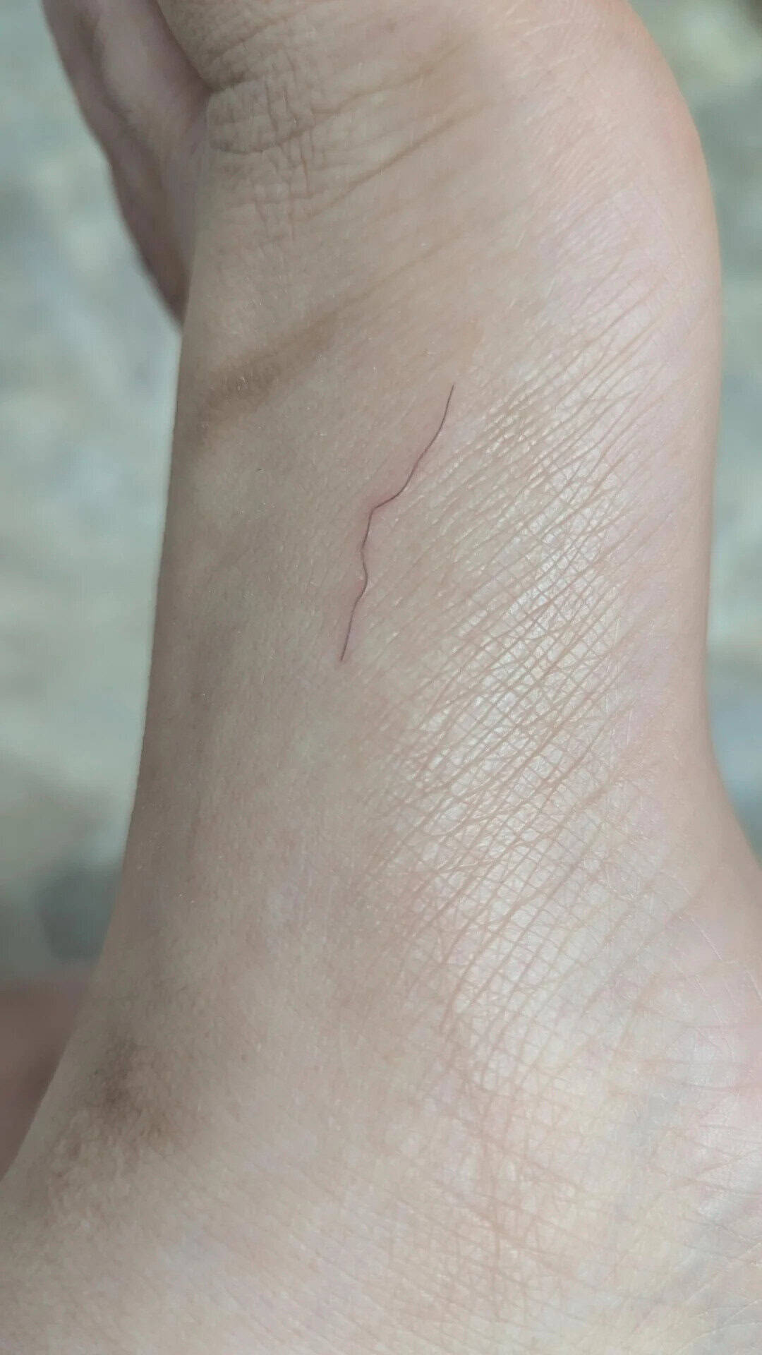 Close-up of a wrist with a small, thin, red scratch.
