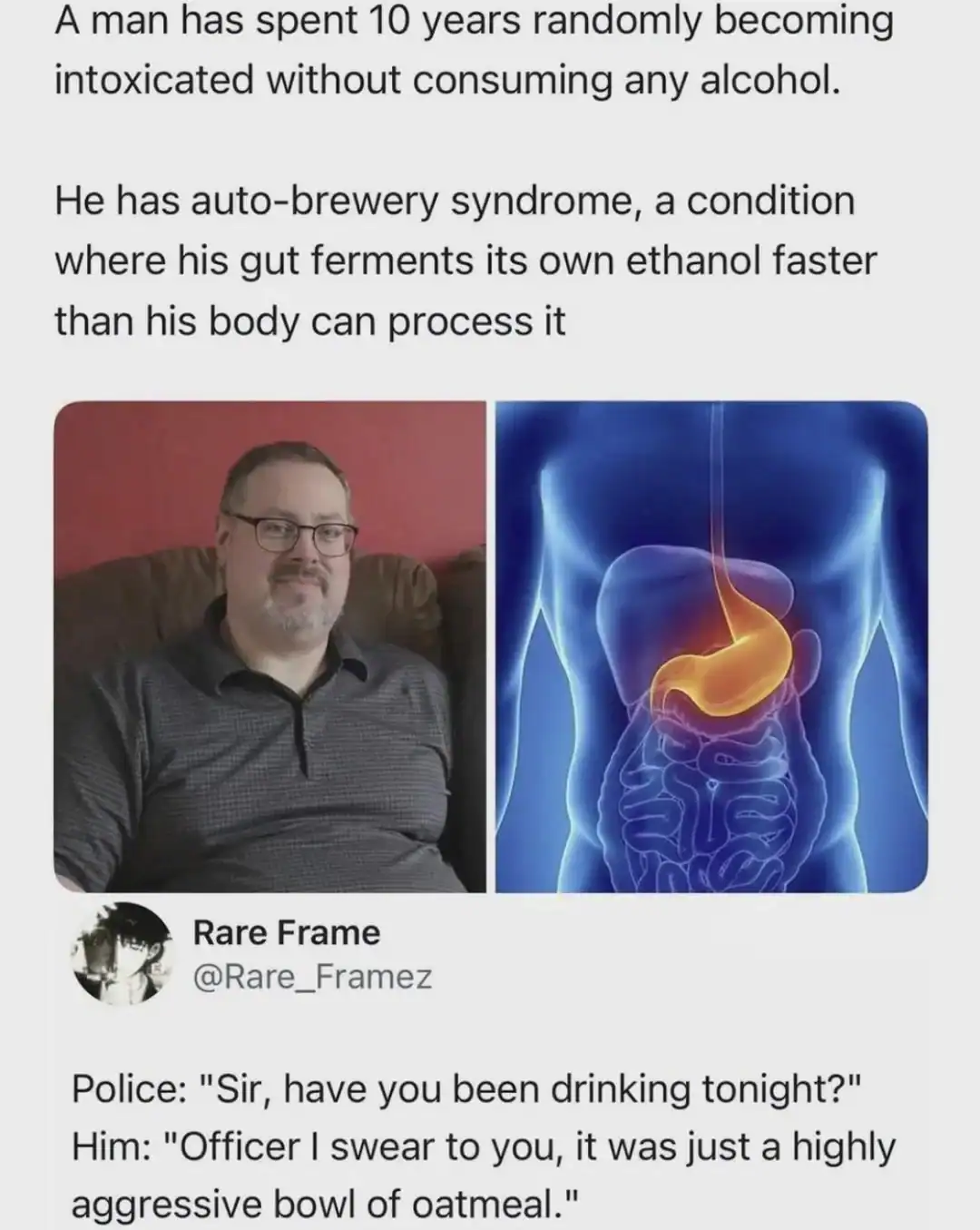 Man with glasses and beard, sitting on a couch, next to an illustration of a stomach with ethanol.
