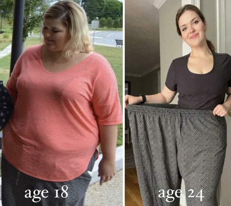 Before and after weight loss photos of an 18-year-old woman, showing significant transformation.
