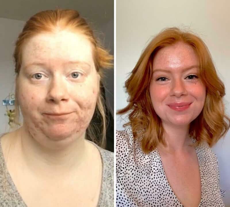 Before and after weight loss photos of a woman with red hair, showing significant transformation.