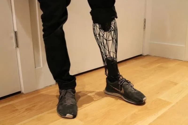 Person wearing a 3D-printed robotic leg on their right side.