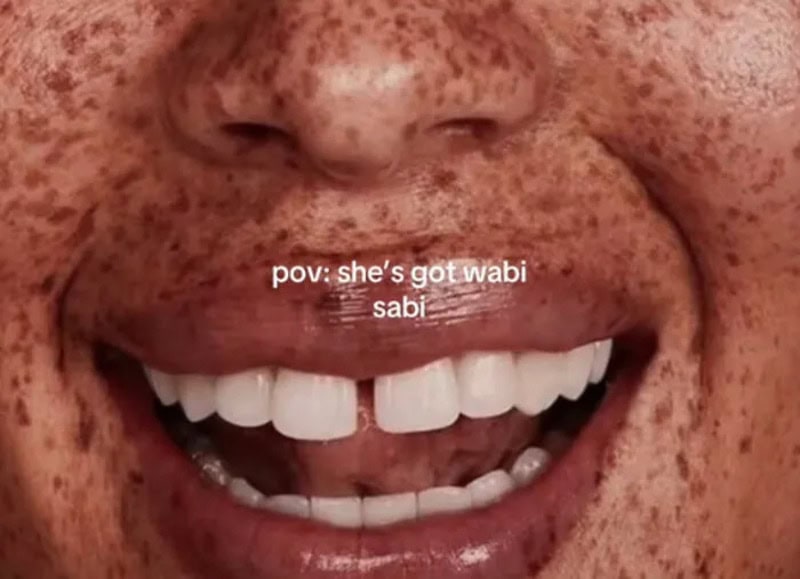 Close-up of a smiling person with freckles and missing front teeth.