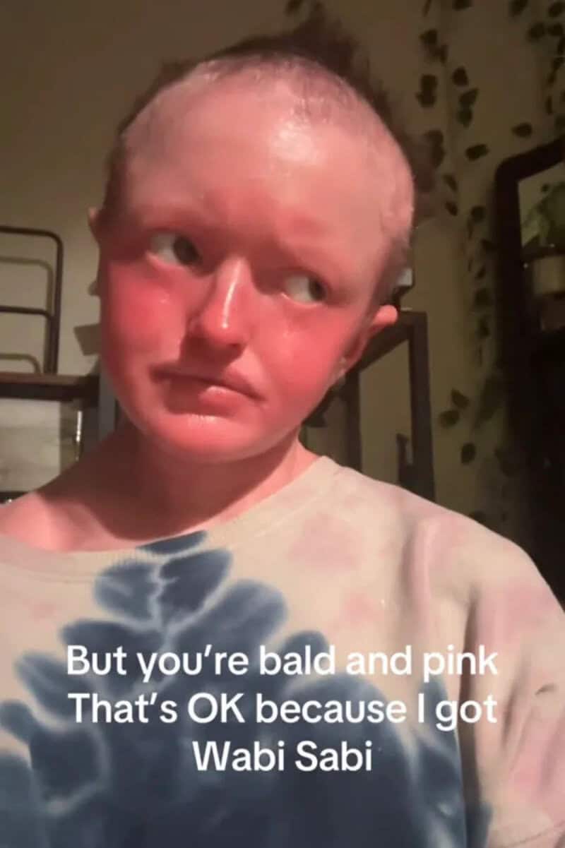 Bald, pink-skinned person with a serious expression, wearing a tie-dye shirt.