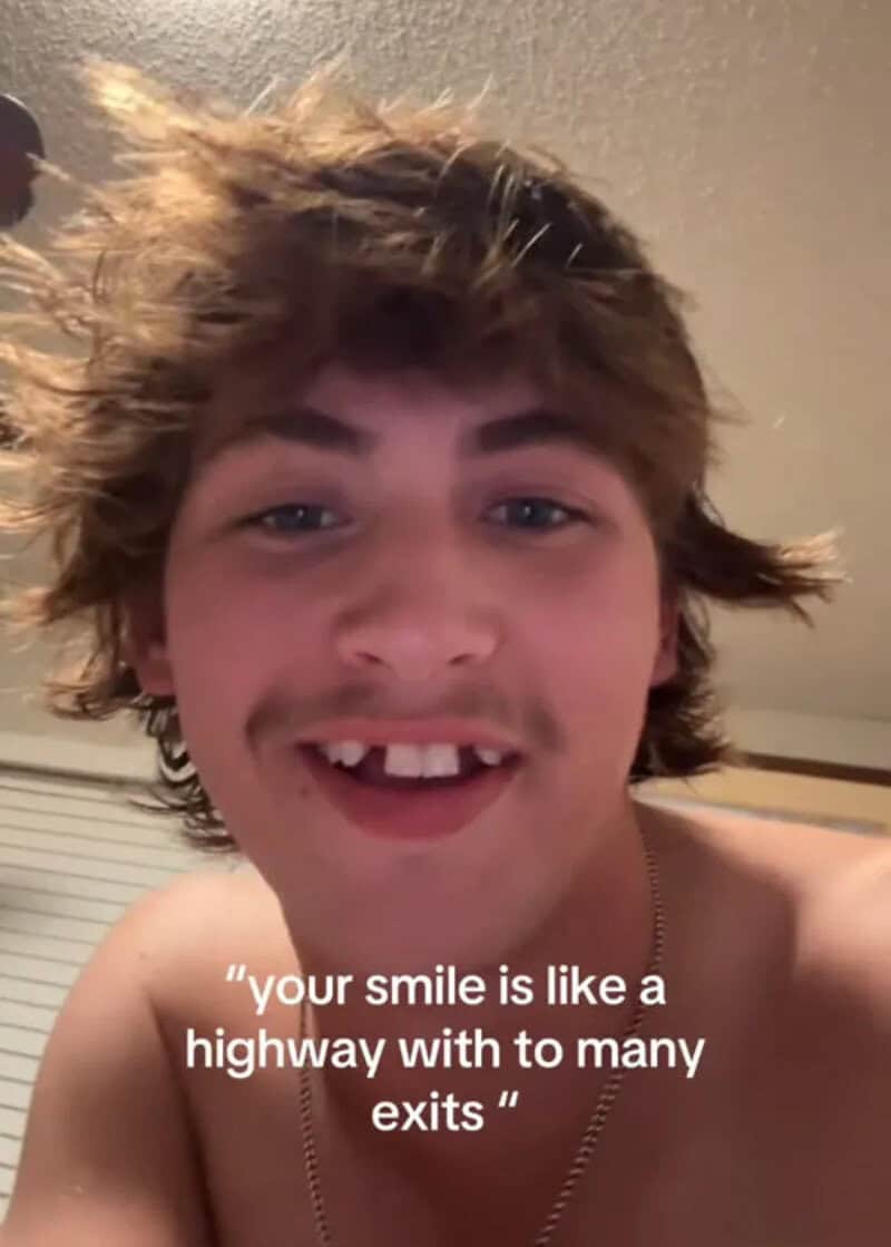 Young man with messy hair and missing front teeth smiling.