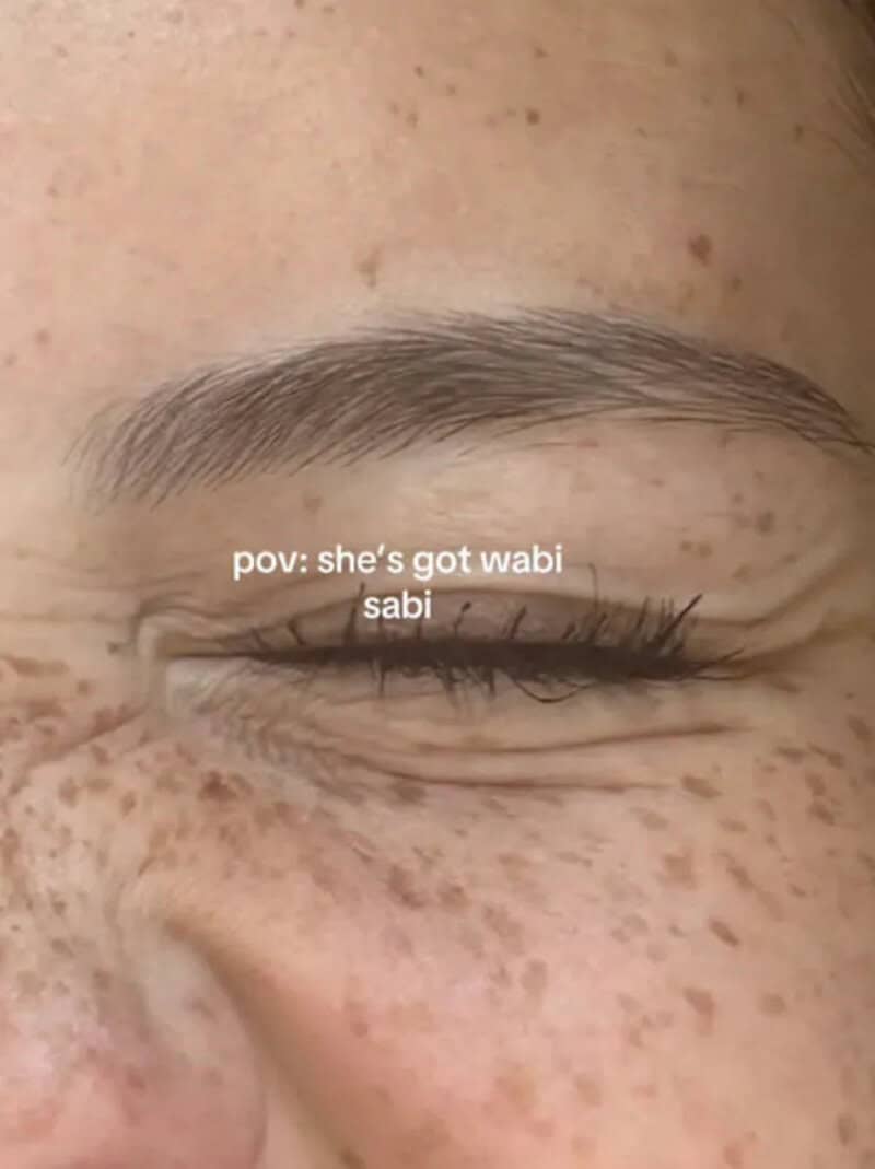 Close-up of a closed eye with freckles, with text 'pov: she's got wabi sabi'.