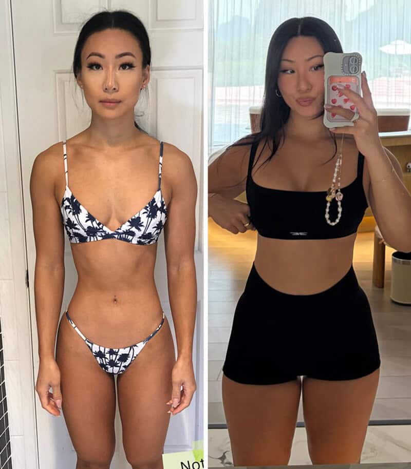 Before and after weight gain transformation of a woman in two photos.