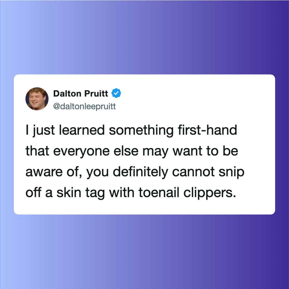 Tweet by Dalton Pruitt about skin tags and toenail clippers.