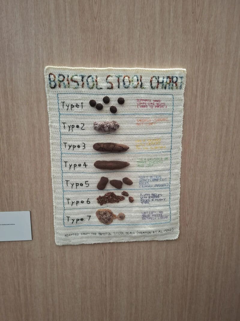 Bristol Stool Chart with different types of stool samples on a cloth.