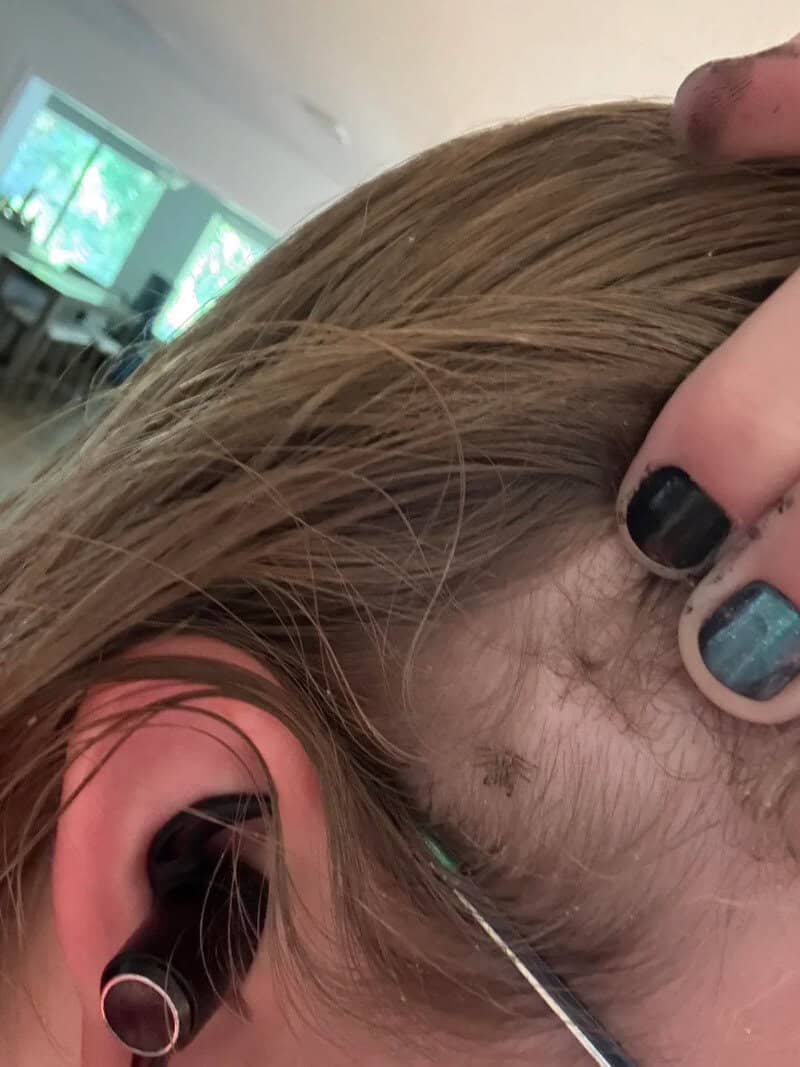 Close-up of a person's ear with a hair strand and a piercing, with a hand holding a needle nearby.