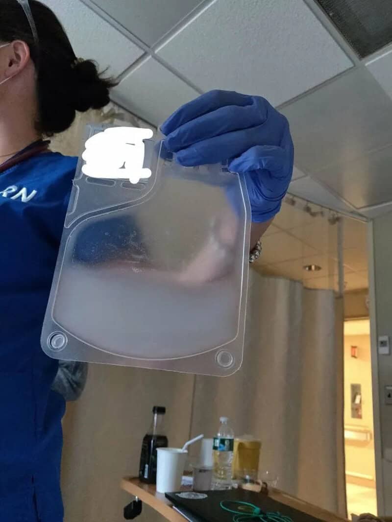 Person in blue gloves holding a transparent plastic container with fog inside.
