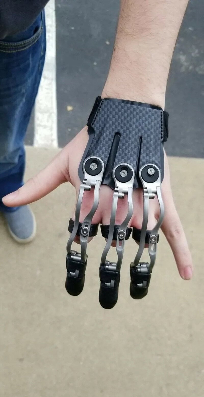 A person with a robotic prosthetic hand with four fingers, each with a joint, on a sidewalk.