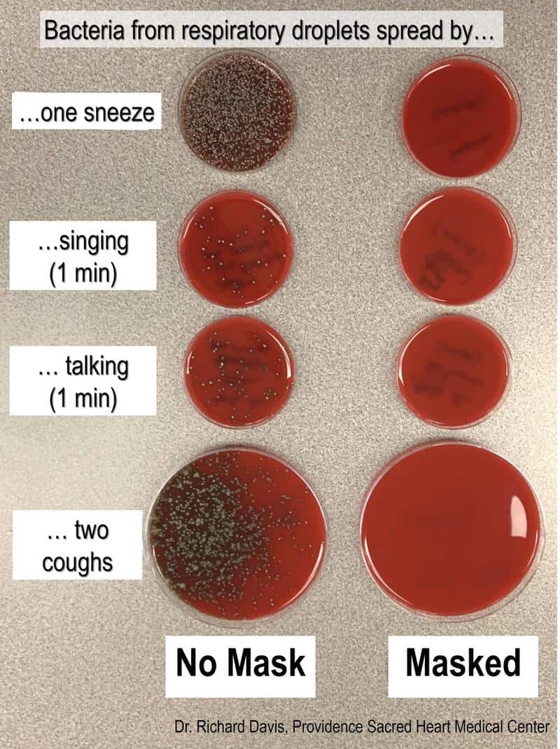 Comparison of bacteria spread from respiratory droplets with and without mask.