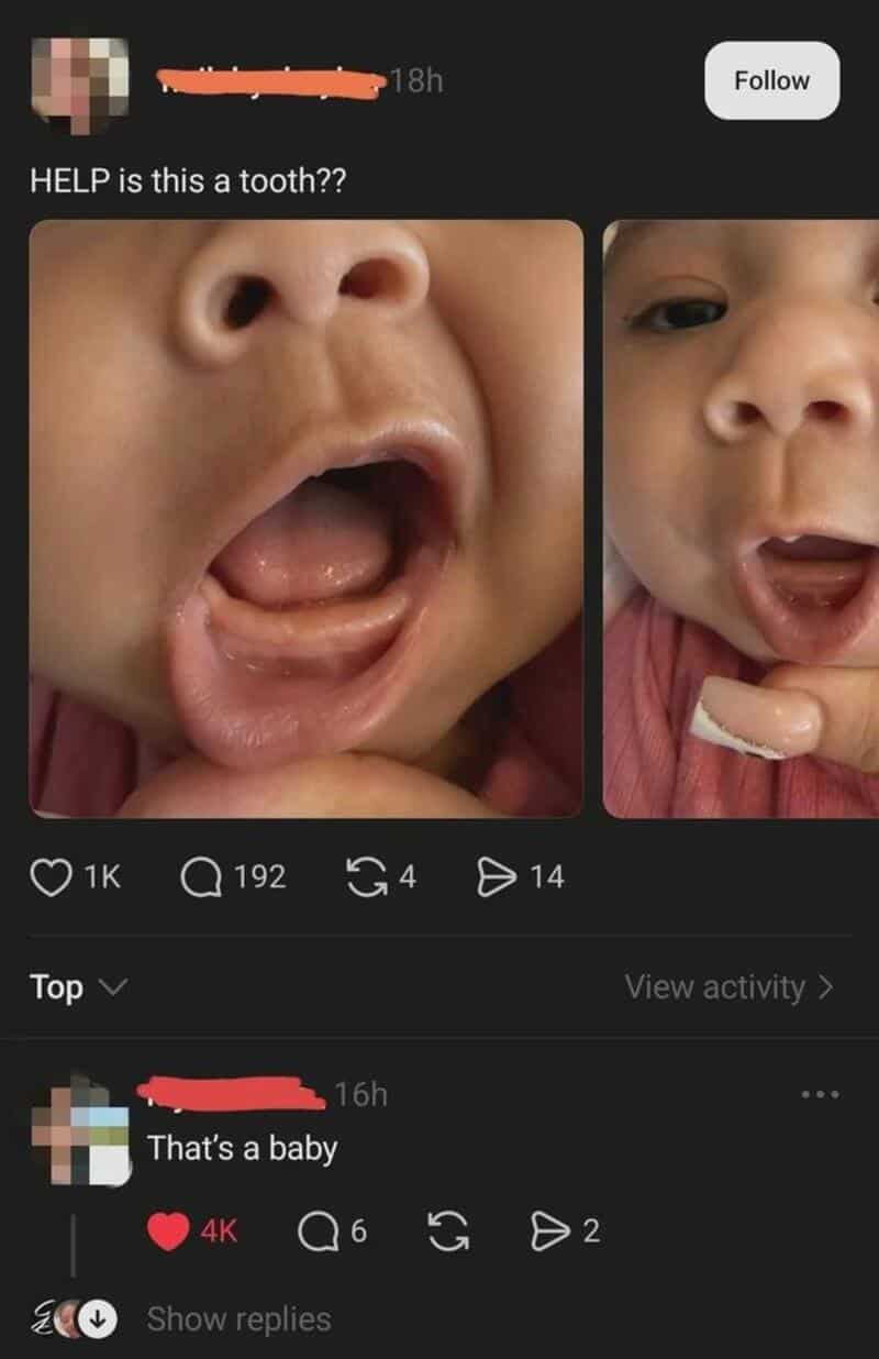 Close-up of a baby's open mouth showing a tooth emerging.