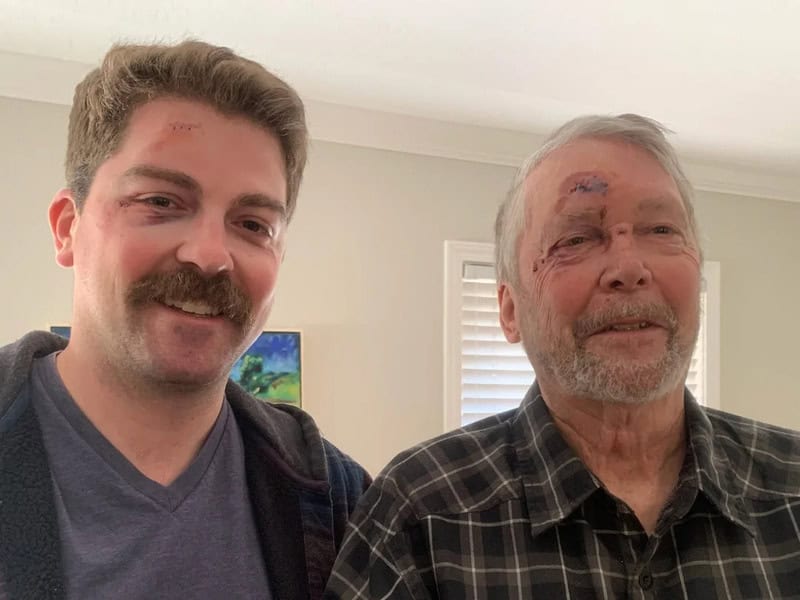 Two men, one young and one elderly, with facial injuries, smiling indoors.